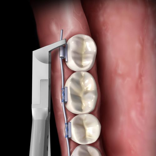 Hu-friedy_Slim Flush Cut and Hold Distal End Cutter, Long Handle_Quintess-Denta