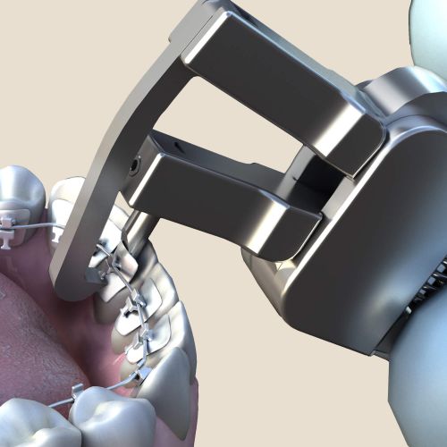 Hu-friedy_Lingual Debonding Pliers_Quintess-Denta