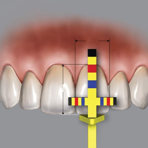 Hu-friedy_T-Bar Replacement Tips (3 Tips)_Quintess-Denta